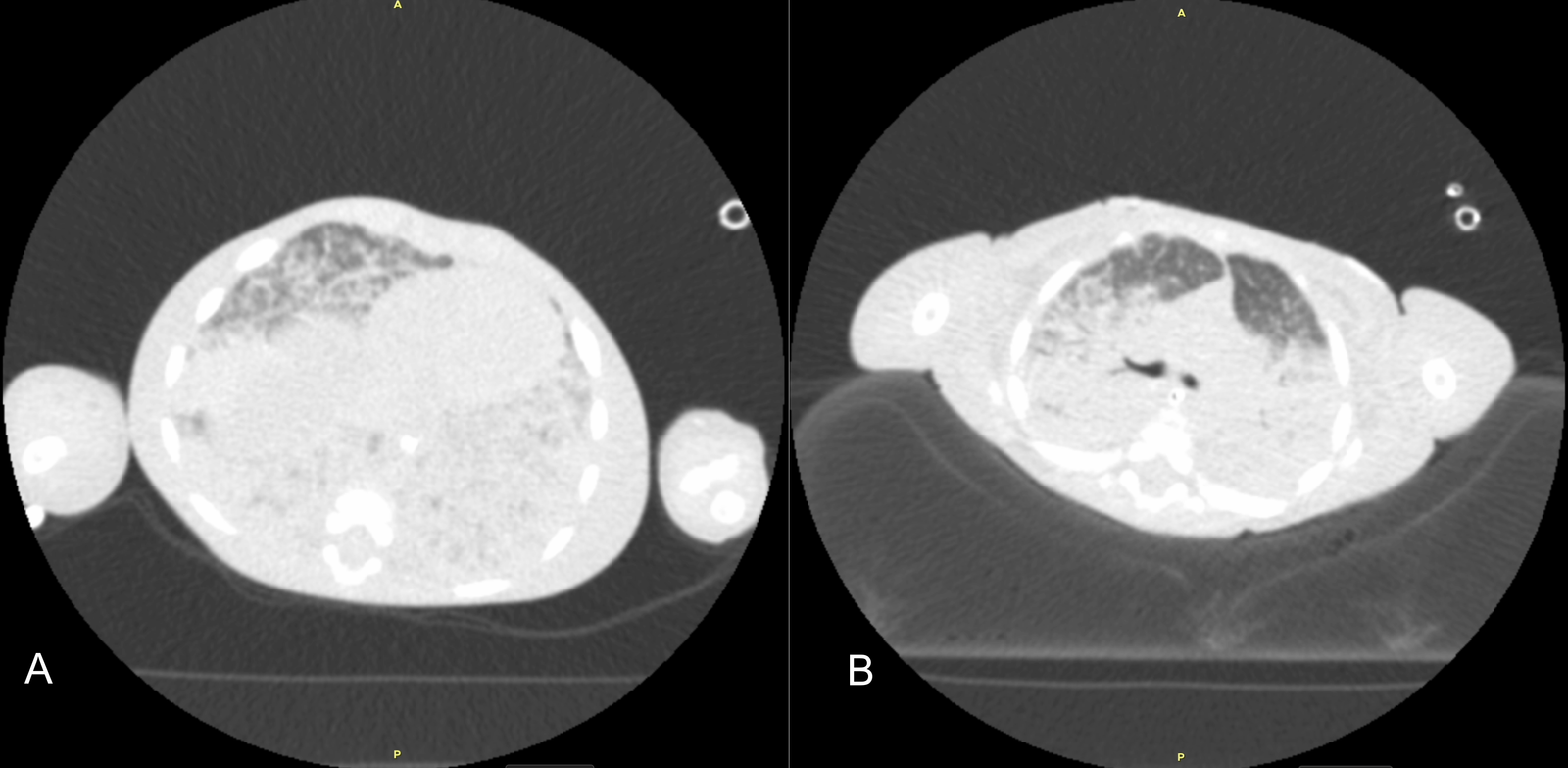 Initial axial chest computed tomography images
